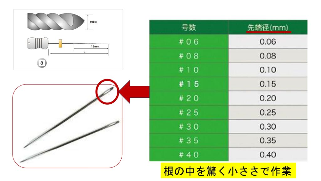 Ｑ＆Ａ　根の治療、何してるの？