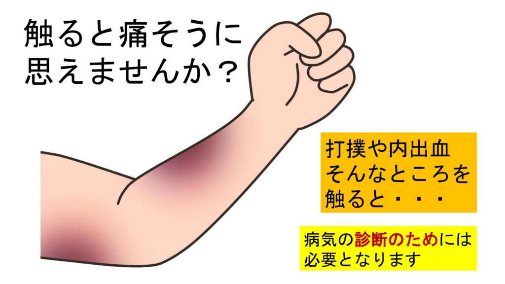 Ｑ＆Ａ　歯ぐきの検査が痛いのは？
